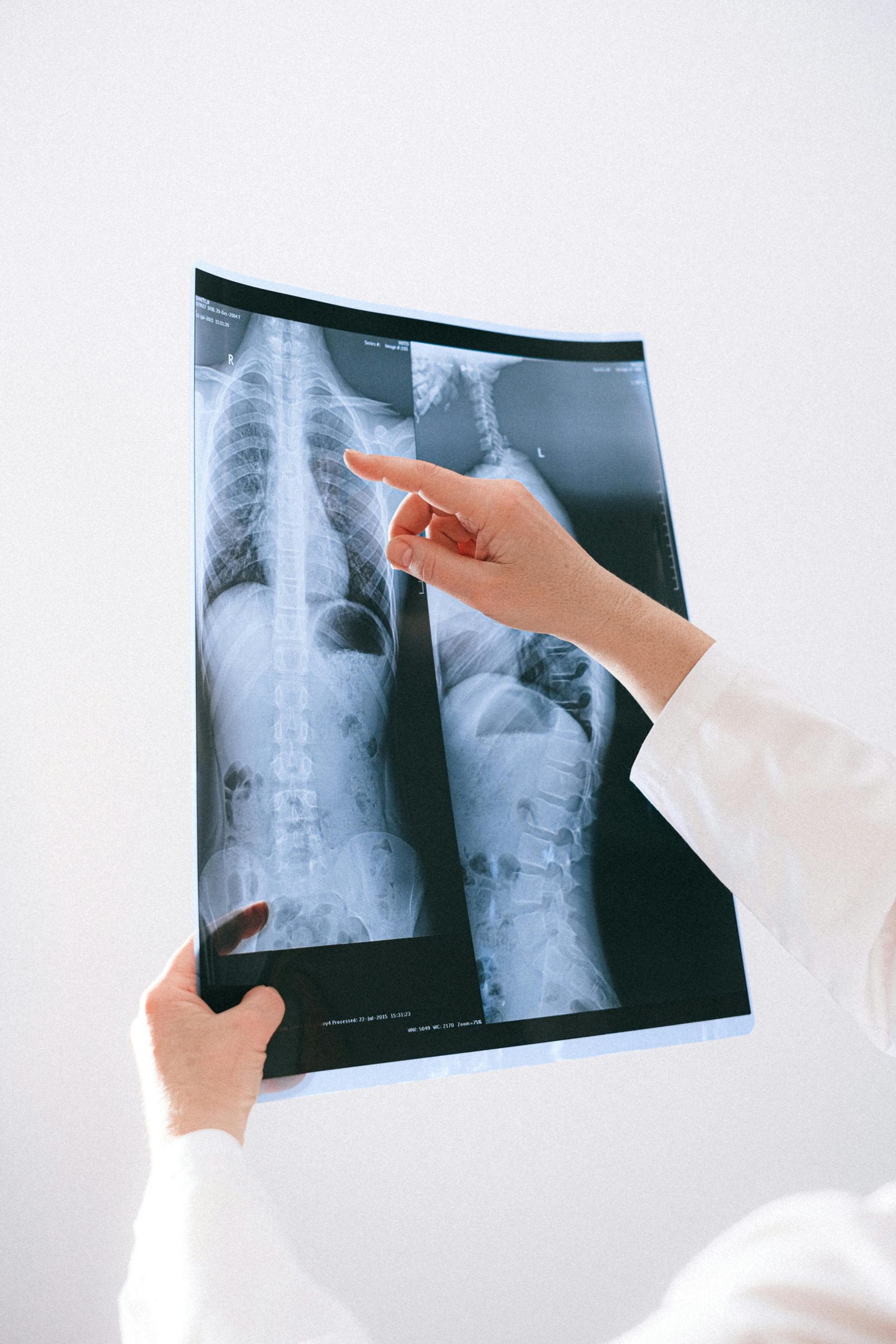 Fairfield County Spine Surgeon